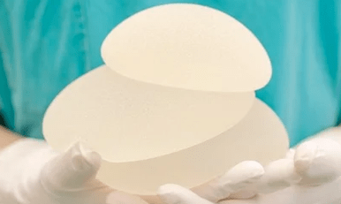 用于增大胸部的乳房植入物