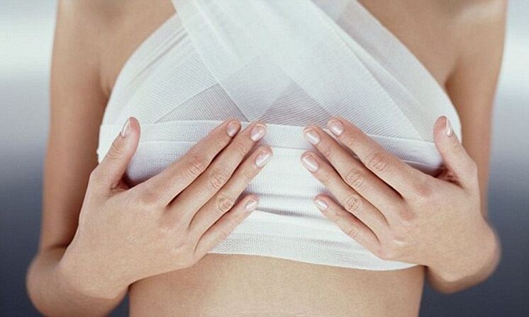 隆胸手术后乳房用绷带包扎